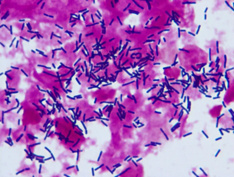 疾控中心微生物檢測實(shí)驗(yàn)室顯微鏡